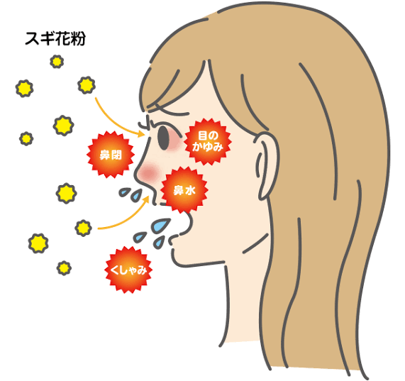 スギ花粉による花粉症の説明イラスト